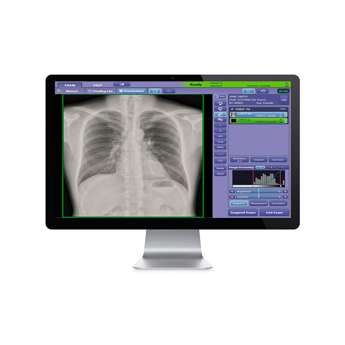 CXDI Control Software NE